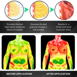 ❤️NEW YEAR NEW YOU LIMITED SALE!! | Save 50% Today - RZXEA™ Gynecomastia 3 in1 Nano Microneedle Patch