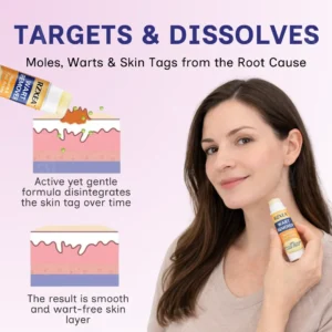 ❤️Valentine's Day Sale | RZXEA™ | Solid-Stick Wart Remover, Skin Tags in Just 48 Hours!