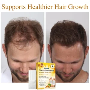 🚨 Stocks Are Running Low.| RZXEA™ Nano-Bee Venom All-in-One Vitality Patch