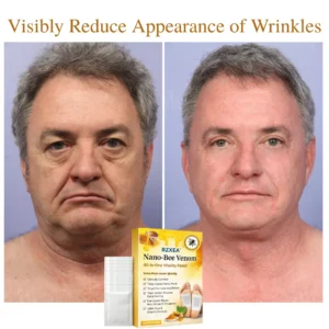 🚨 Stocks Are Running Low.| RZXEA™ Nano-Bee Venom All-in-One Vitality Patch