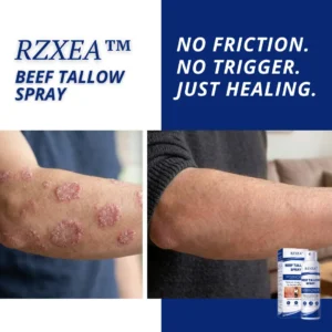 RZXEA™ Beef Tallow Spray✨ Finally, Skin That Doesn’t Need to Be Hidden